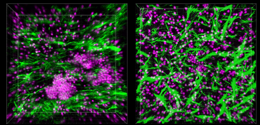 قرار گرفتن سیستم ایمنی با تمام پیچیدگی اش بر روی تراشه های میکروسیالی